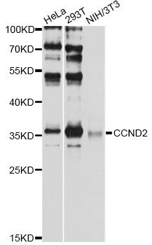CCND2 / Cyclin D2 Antibody - Western blot analysis of extracts of various cell lines, using CCND2 antibody at 1:1000 dilution. The secondary antibody used was an HRP Goat Anti-Rabbit IgG (H+L) at 1:10000 dilution. Lysates were loaded 25ug per lane and 3% nonfat dry milk in TBST was used for blocking. An ECL Kit was used for detection and the exposure time was 30s.