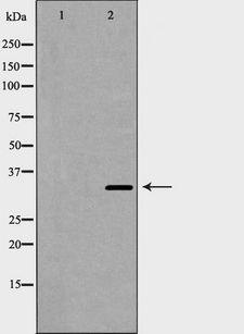 CCND2 / Cyclin D2 Antibody - Western blot analysis of Cyclin D2 expression in 293 cells. The lane on the left is treated with the antigen-specific peptide.