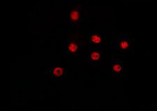 CCND2 / Cyclin D2 Antibody - Staining HeLa cells by IF/ICC. The samples were fixed with PFA and permeabilized in 0.1% Triton X-100, then blocked in 10% serum for 45 min at 25°C. The primary antibody was diluted at 1:200 and incubated with the sample for 1 hour at 37°C. An Alexa Fluor 594 conjugated goat anti-rabbit IgG (H+L) Ab, diluted at 1/600, was used as the secondary antibody.