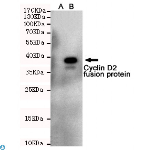 CCND2 / Cyclin D2 Antibody - Western blot detection of Cyclin D2 in CHO-K1 cell lysate (A) and CHO-K1 transfected by Cyclin D2-fragment EGFP fusion protein (B) cell lysate using Cyclin D2 mouse mAb (1:1000 diluted). Predicted band size: 38KDa. Observed band size: 38KDa.