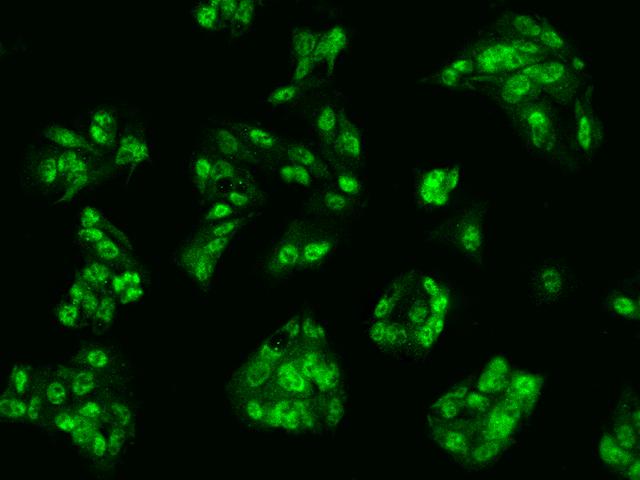 CCND2 / Cyclin D2 Antibody - Immunofluorescence staining of CCND2 in HepG2 cells. Cells were fixed with 4% PFA, permeabilzed with 0.1% Triton X-100 in PBS, blocked with 10% serum, and incubated with rabbit anti-Human CCND2 polyclonal antibody (dilution ratio 1:200) at 4°C overnight. Then cells were stained with the Alexa Fluor 488-conjugated Goat Anti-rabbit IgG secondary antibody (green). Positive staining was localized to Nucleus and Cytoplasm.