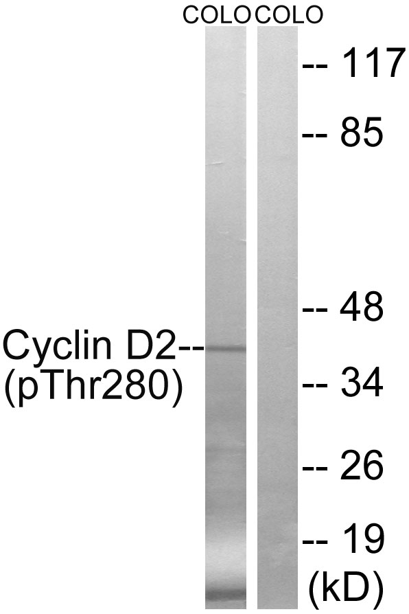 CCND2 / Cyclin D2 Antibody - Western blot analysis of lysates from COLO205 cells treated with EGF 200ng/ml 30', using Cyclin D2 (Phospho-Thr280) Antibody. The lane on the right is blocked with the phospho peptide.