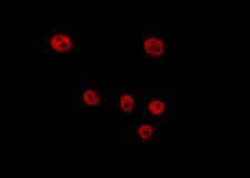 CCND2 / Cyclin D2 Antibody - Staining HeLa cells by IF/ICC. The samples were fixed with PFA and permeabilized in 0.1% Triton X-100, then blocked in 10% serum for 45 min at 25°C. The primary antibody was diluted at 1:200 and incubated with the sample for 1 hour at 37°C. An Alexa Fluor 594 conjugated goat anti-rabbit IgG (H+L) Ab, diluted at 1/600, was used as the secondary antibody.