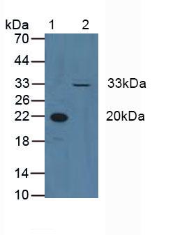 CCND3 / Cyclin D3 Antibody - Western Blot; Sample: Lane1: Human Blood Cells; Lane2: Human Hela Cells.