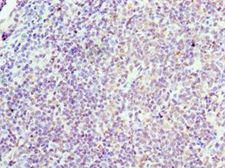 CCND3 / Cyclin D3 Antibody - Immunohistochemistry of paraffin-embedded human tonsil tissue using antibody at 1:100 dilution.