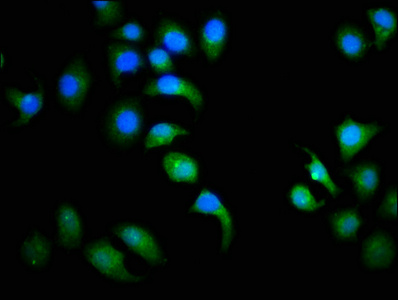 CCND3 / Cyclin D3 Antibody - Immunofluorescence staining of A549 cells with CCND3 Antibody at 1:113, counter-stained with DAPI. The cells were fixed in 4% formaldehyde, permeabilized using 0.2% Triton X-100 and blocked in 10% normal Goat Serum. The cells were then incubated with the antibody overnight at 4°C. The secondary antibody was Alexa Fluor 488-congugated AffiniPure Goat Anti-Rabbit IgG(H+L).