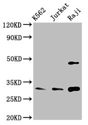 CCND3 / Cyclin D3 Antibody - Western Blot Positive WB detected in: K562 whole cell lysate, Jurkat whole cell lysate, Raji whole cell lysate All lanes: CCND3 antibody at 3.4µg/ml Secondary Goat polyclonal to rabbit IgG at 1/50000 dilution Predicted band size: 33 kDa Observed band size: 33 kDa