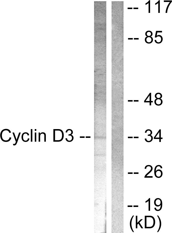 CCND3 / Cyclin D3 Antibody - Western blot analysis of lysates from COS7 cells, treated with Forskolin 40nM 30', using Cyclin D3 Antibody. The lane on the right is blocked with the synthesized peptide.