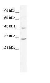 CCND3 / Cyclin D3 Antibody - Jurkat Cell Lysate.  This image was taken for the unconjugated form of this product. Other forms have not been tested.