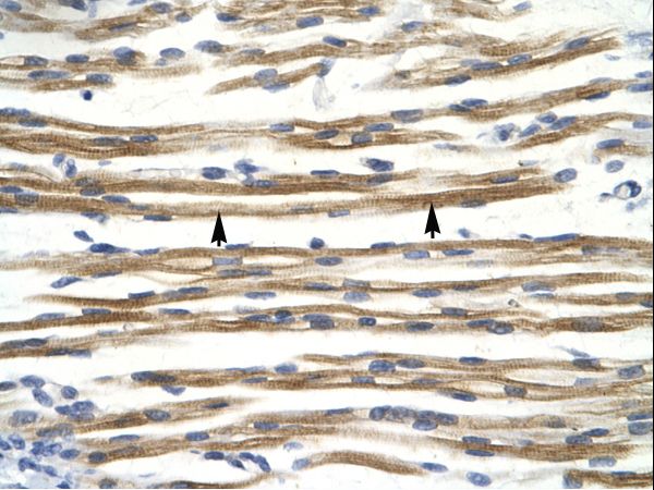 CCND3 / Cyclin D3 Antibody - CCND3 / Cyclin D3 antibody AVARP03038_P050-NP_001751-CCND3 (cyclin D3) Antibody was used in IHC to stain formalin-fixed, paraffin-embedded human muscle.  This image was taken for the unconjugated form of this product. Other forms have not been tested.