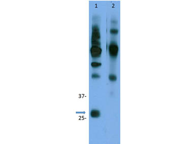 CCND3 / Cyclin D3 Antibody - Immunoprecipitation of rabbit Anti-Cyclin D3. Lane 1: 5µg anti-cyclin D3 antibody/IP. Primary Antibody: Cyclin D3 Mouse mAb. Lane 2: 5µg anti-cyclin D3 antibody/IP. Primary Antibody: Cyclin D2 rabbit pAB. Secondary Antibody: TrueBlot IgG IP beads. Expect: ~32kDa to D3 in lane 1. No reactivity to D2 in lane 2.
