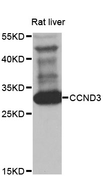 CCND3 / Cyclin D3 Antibody - Western blot analysis of extracts of rat liver, using CCND3 antibody at 1:1000 dilution. The secondary antibody used was an HRP Goat Anti-Rabbit IgG (H+L) at 1:10000 dilution. Lysates were loaded 25ug per lane and 3% nonfat dry milk in TBST was used for blocking. An ECL Kit was used for detection and the exposure time was 10s.