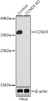 CCND3 / Cyclin D3 Antibody - Western blot analysis of extracts from normal (control) and CCND3 knockout (KO) HeLa cells, using CCND3 antibody at 1:1000 dilution. The secondary antibody used was an HRP Goat Anti-Rabbit IgG (H+L) at 1:10000 dilution. Lysates were loaded 25ug per lane and 3% nonfat dry milk in TBST was used for blocking. An ECL Kit was used for detection and the exposure time was 90s.
