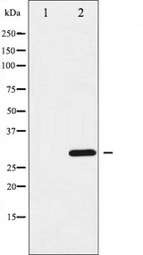 CCND3 / Cyclin D3 Antibody - Western blot analysis of Cyclin D3 expression in Forskolin treated COS7 whole cells lysates. The lane on the left is treated with the antigen-specific peptide.