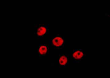 CCND3 / Cyclin D3 Antibody - Staining HepG2 cells by IF/ICC. The samples were fixed with PFA and permeabilized in 0.1% Triton X-100, then blocked in 10% serum for 45 min at 25°C. The primary antibody was diluted at 1:200 and incubated with the sample for 1 hour at 37°C. An Alexa Fluor 594 conjugated goat anti-rabbit IgG (H+L) Ab, diluted at 1/600, was used as the secondary antibody.