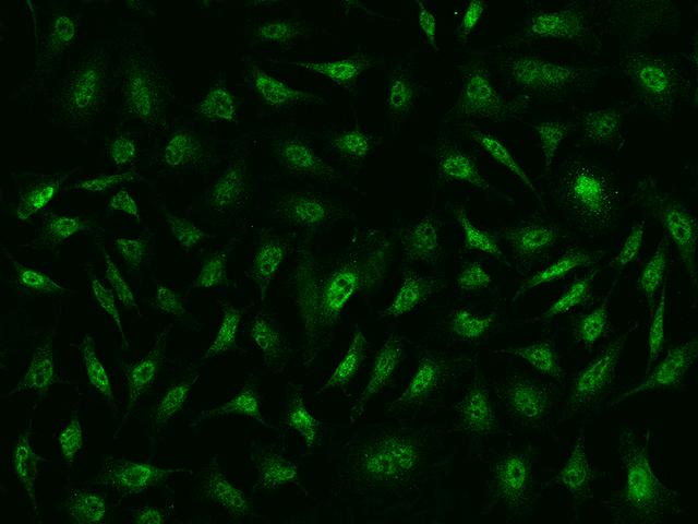 CCND3 / Cyclin D3 Antibody - Immunofluorescence staining of CCND3 in HeLa cells. Cells were fixed with 4% PFA, permeabilzed with 0.1% Triton X-100 in PBS, blocked with 10% serum, and incubated with rabbit anti-Human CCND3 polyclonal antibody (dilution ratio 1:1000) at 4°C overnight. Then cells were stained with the Alexa Fluor 488-conjugated Goat Anti-rabbit IgG secondary antibody (green). Positive staining was localized to nucleus and cytoplasm.