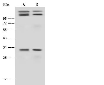 CCND3 / Cyclin D3 Antibody - Anti-CCND3 rabbit polyclonal antibody at 1:500 dilution. Lane A: HeLa Whole Cell Lysate. Lane B: Jurkat Whole Cell Lysate. Lysates/proteins at 30 ug per lane. Secondary: Goat Anti-Rabbit IgG (H+L)/HRP at 1/10000 dilution. Developed using the ECL technique. Performed under reducing conditions. Predicted band size: 33 kDa.