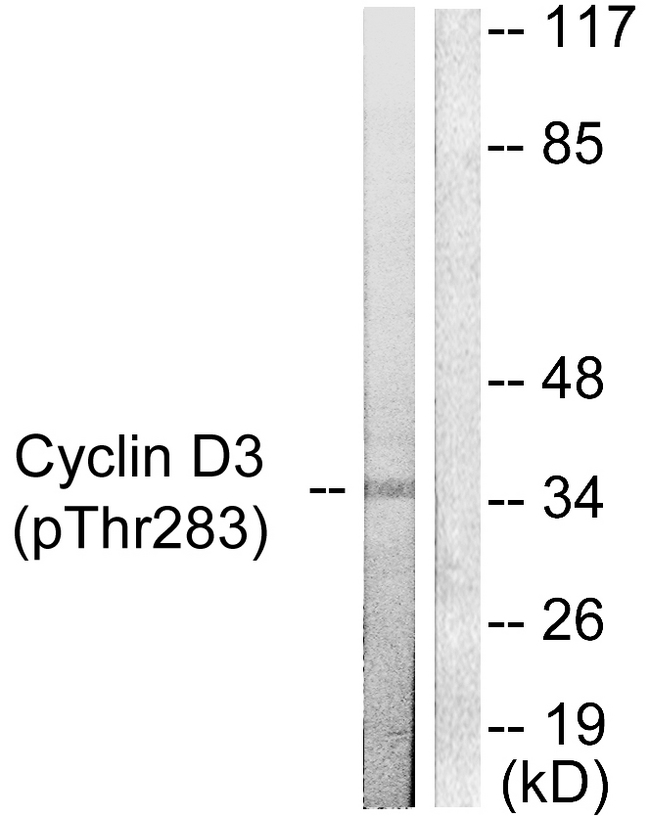 CCND3 / Cyclin D3 Antibody - Western blot analysis of lysates from K562 cells treated with UV 5', using Cyclin D3 (Phospho-Thr283) Antibody. The lane on the right is blocked with the phospho peptide.