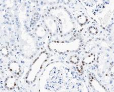 CCND3 / Cyclin D3 Antibody - 1:100 staining human kidney tissue by IHC-P. The tissue was formaldehyde fixed and a heat mediated antigen retrieval step in citrate buffer was performed. The tissue was then blocked and incubated with the antibody for 1.5 hours at 22°C. An HRP conjugated goat anti-rabbit antibody was used as the secondary.
