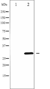 CCND3 / Cyclin D3 Antibody - Western blot analysis of Cyclin D3 phosphorylation expression in UV treated K562 whole cells lysates. The lane on the left is treated with the antigen-specific peptide.