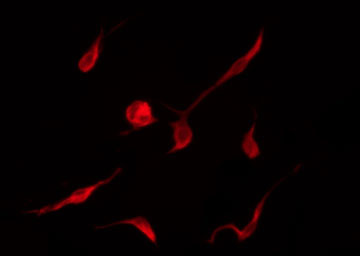 CCND3 / Cyclin D3 Antibody - Staining K562 cells by IF/ICC. The samples were fixed with PFA and permeabilized in 0.1% Triton X-100, then blocked in 10% serum for 45 min at 25°C. The primary antibody was diluted at 1:200 and incubated with the sample for 1 hour at 37°C. An Alexa Fluor 594 conjugated goat anti-rabbit IgG (H+L) Ab, diluted at 1/600, was used as the secondary antibody.