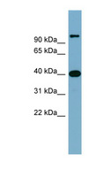 CCNDBP1 / GCIP Antibody - CCNDBP1 / GCIP antibody Western blot of Fetal Small Intestine lysate. This image was taken for the unconjugated form of this product. Other forms have not been tested.