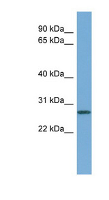 CCNDBP1 / GCIP Antibody - CCNDBP1 / GCIP antibody Western blot of Fetal Liver lysate. This image was taken for the unconjugated form of this product. Other forms have not been tested.
