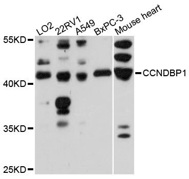 CCNDBP1 / GCIP Antibody - Western blot analysis of extracts of various cell lines, using CCNDBP1 antibody at 1:3000 dilution. The secondary antibody used was an HRP Goat Anti-Rabbit IgG (H+L) at 1:10000 dilution. Lysates were loaded 25ug per lane and 3% nonfat dry milk in TBST was used for blocking. An ECL Kit was used for detection and the exposure time was 90s.