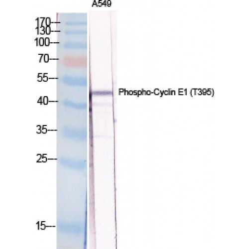 CCNE1 / Cyclin E1 Antibody - Western blot of Phospho-Cyclin E1 (T395) antibody