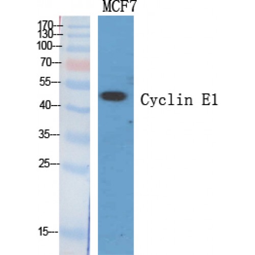CCNE1 / Cyclin E1 Antibody - Western blot of Cyclin E1 antibody