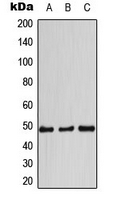 CCNE1 / Cyclin E1 Antibody - Western blot analysis of Cyclin E1 expression in MCF7 (A); mouse liver (B); rat kidney (C) whole cell lysates.