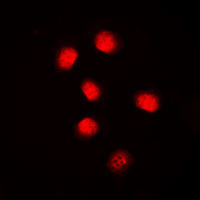 CCNE1 / Cyclin E1 Antibody - Immunofluorescent analysis of Cyclin E1 staining in MCF7 cells. Formalin-fixed cells were permeabilized with 0.1% Triton X-100 in TBS for 5-10 minutes and blocked with 3% BSA-PBS for 30 minutes at room temperature. Cells were probed with the primary antibody in 3% BSA-PBS and incubated overnight at 4 C in a humidified chamber. Cells were washed with PBST and incubated with a DyLight 594-conjugated secondary antibody (red) in PBS at room temperature in the dark. DAPI was used to stain the cell nuclei (blue).