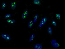 CCNE1 / Cyclin E1 Antibody - Immunofluorescence staining of CCNE1 in Hela cells. Cells were fixed with 4% PFA, permeabilzed with 0.1% Triton X-100 in PBS, blocked with 10% serum, and incubated with mouse anti-human CCNE1 monoclonal antibody (dilution ratio 1:60) at 4°C overnight. Then cells were stained with the Alexa Fluor 488-conjugated Goat Anti-mouse IgG secondary antibody (green) and counterstained with DAPI (blue). Positive staining was localized to nucleolus.