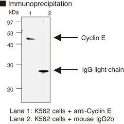 CCNE1 / Cyclin E1 Antibody