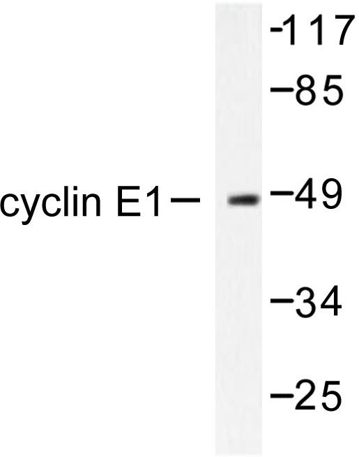 CCNE1 / Cyclin E1 Antibody - Western blot of Cyclin E1 (I119) pAb in extracts from K562 cell.