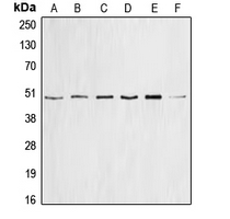 CCNE1 / Cyclin E1 Antibody - Western blot analysis of Cyclin E1 expression in HEK293T (A); mouse brain (B); PC12 (C); SW626 (D); HeLa (E); K562 (F) whole cell lysates.