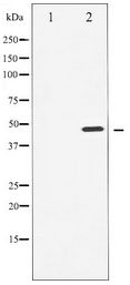 CCNE1 / Cyclin E1 Antibody - Western blot of Cyclin E1 expression in Paclitaxel treated HeLa whole cell lysates,The lane on the left is treated with the antigen-specific peptide.