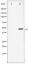 CCNE1 / Cyclin E1 Antibody - Western blot of Cyclin E1 expression in Paclitaxel treated HeLa whole cell lysates,The lane on the left is treated with the antigen-specific peptide.