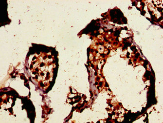 CCNE1 / Cyclin E1 Antibody - Immunohistochemistry image of paraffin-embedded human testis tissue at a dilution of 1:100