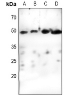 CCNE1 / Cyclin E1 Antibody - Western blot analysis of Cyclin E1 expression in HepG2 (A), MCF7 (B), K562 (C), mouse lung (D) whole cell lysates.