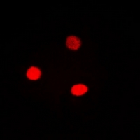 CCNE1 / Cyclin E1 Antibody - Immunofluorescent analysis of Cyclin E1 staining in HeLa cells. Formalin-fixed cells were permeabilized with 0.1% Triton X-100 in TBS for 5-10 minutes and blocked with 3% BSA-PBS for 30 minutes at room temperature. Cells were probed with the primary antibody in 3% BSA-PBS and incubated overnight at 4 °C in a hidified chamber. Cells were washed with PBST and incubated with Alexa Fluor 647-conjugated secondary antibody (red) in PBS at room temperature in the dark.