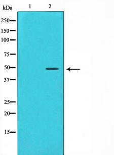 CCNE1 / Cyclin E1 Antibody - Western blot analysis on HeLa cell lysates using Cyclin E1 antibody. The lane on the left is treated with the antigen-specific peptide.