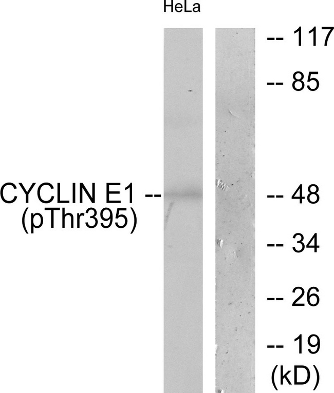 CCNE1 / Cyclin E1 Antibody - Western blot analysis of lysates from HeLa cells treated with Paclitaxel 1uM 60', using Cyclin E1 (Phospho-Thr395) Antibody. The lane on the right is blocked with the phospho peptide.