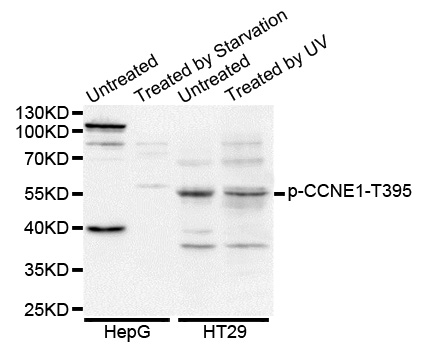 CCNE1 / Cyclin E1 Antibody - Western blot analysis of extracts of various cell lines.