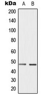 CCNE1 / Cyclin E1 Antibody - Western blot analysis of Cyclin E1 (pT395) expression in HepG2 (A); JAR (B) whole cell lysates.