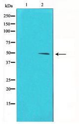CCNE1 / Cyclin E1 Antibody - Western blot of Cyclin E1 phosphorylation expression in Paclitaxel treated HeLa whole cell lysates,The lane on the left is treated with the antigen-specific peptide.