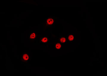 CCNE1 / Cyclin E1 Antibody - Staining MCF-7 cells by IF/ICC. The samples were fixed with PFA and permeabilized in 0.1% Triton X-100, then blocked in 10% serum for 45 min at 25°C. The primary antibody was diluted at 1:200 and incubated with the sample for 1 hour at 37°C. An Alexa Fluor 594 conjugated goat anti-rabbit IgG (H+L) Ab, diluted at 1/600, was used as the secondary antibody.