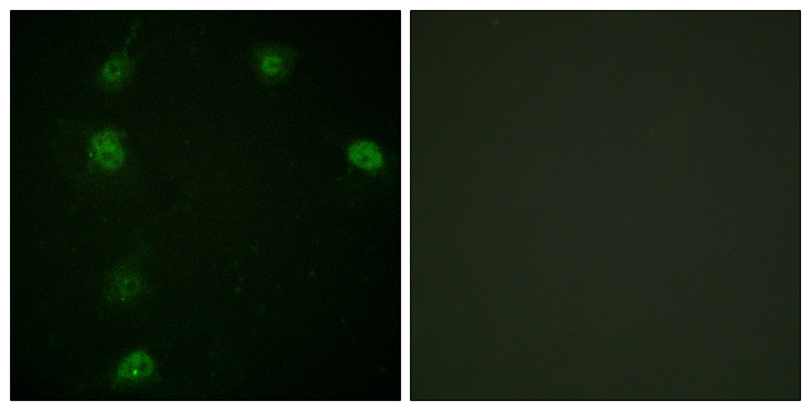 CCNE1 / Cyclin E1 Antibody - Immunofluorescence analysis of HeLa cells, using Cyclin E1 (Phospho-Thr77) Antibody. The picture on the right is blocked with the phospho peptide.