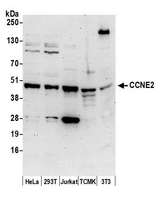 CCNE2 / Cyclin E2 Antibody - Detection of human and mouse CCNE2 by western blot. Samples: Whole cell lysate (50 µg) from HeLa, HEK293T, Jurkat, mouse TCMK-1, and mouse NIH 3T3 cells prepared using NETN lysis buffer. Antibody: Affinity purified rabbit anti-CCNE2 antibody used for WB at 0.1 µg/ml. Detection: Chemiluminescence with an exposure time of 3 minutes.