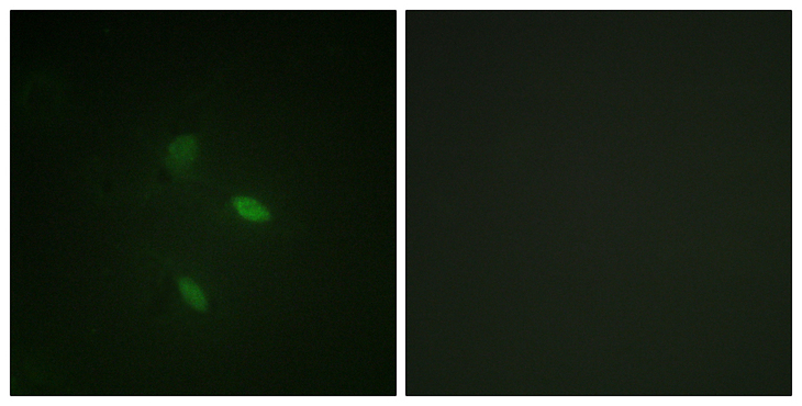 CCNE2 / Cyclin E2 Antibody - Immunofluorescence analysis of NIH/3T3 cells, using Cyclin E2 Antibody. The picture on the right is blocked with the synthesized peptide.